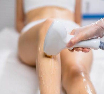 Why Alexandria is the Go-To Destination for Laser Hair Removal